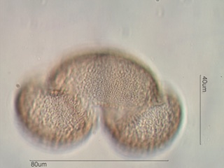 Western White Pine Pollen