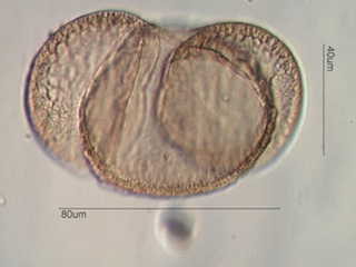 Western White Pine Pollen