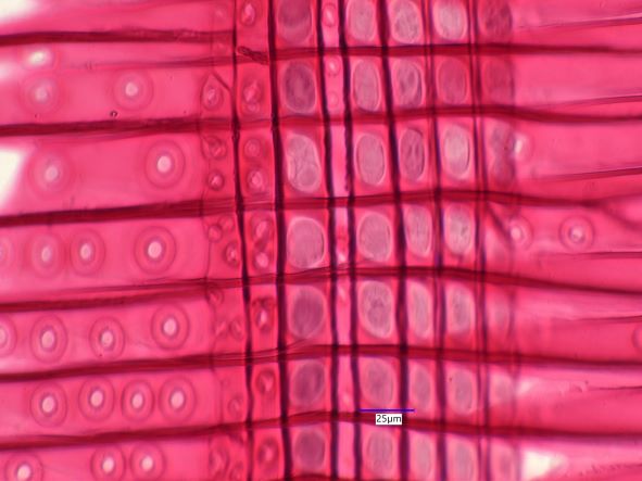 Pinus strobus, Radial Section
