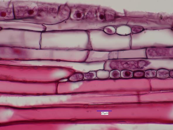Pinus strobus, Tangential Section