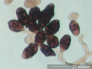 Pithomycetes Spores