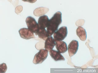 Pithomycetes Spores