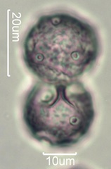 Narrow Leaf Plantain (Plantago lanceloata) Pollen