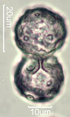 Narrow Leaf Plantain (Plantago lanceloata) Pollen