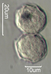 Narrow Leaf Plantain (Plantago lanceloata) Pollen
