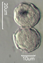 Narrow Leaf Plantain (Plantago lanceloata) Pollen