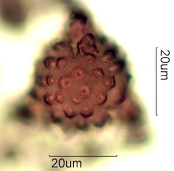 Asteraceae Pollen