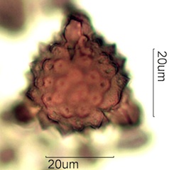 Asteraceae Pollen