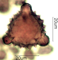 Asteraceae Pollen