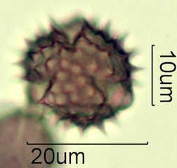Asteraceae Pollen