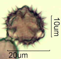 Asteraceae Pollen