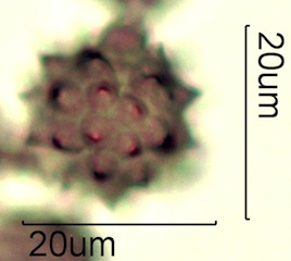 Asteraceae Pollen