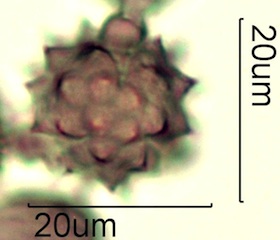Asteraceae Pollen