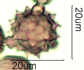 Asteraceae Pollen