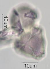 Washington State Honey Pollen Under the Microscope