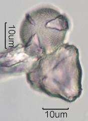 Washington State Honey Pollen Under the Microscope