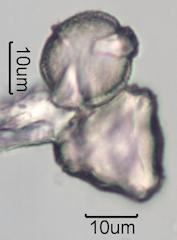 Washington State Honey Pollen Under the Microscope