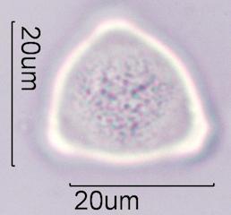 Hazelnut (Corylus sp.) Pollen