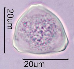 Hazelnut (Corylus sp.) Pollen