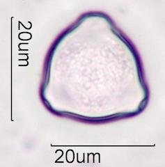 Hazelnut (Corylus sp.) Pollen