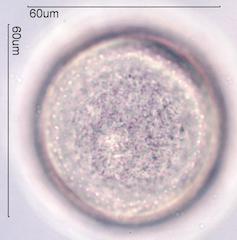 Crocus Pollen