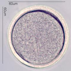 Crocus Pollen