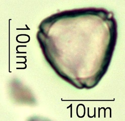 Myrtaceae (Blue Gum Eucalyptus) Pollen Under the Microscope