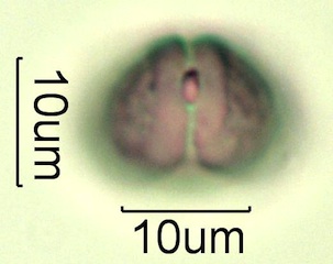 Myrtaceae (Blue Gum Eucalyptus) Pollen Under the Microscope