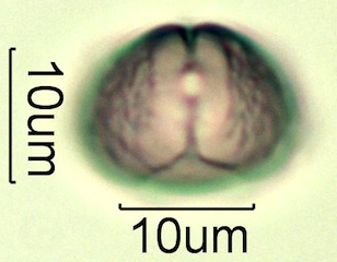 Myrtaceae (Blue Gum Eucalyptus) Pollen Under the Microscope
