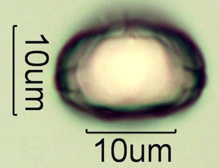 Myrtaceae (Blue Gum Eucalyptus) Pollen Under the Microscope