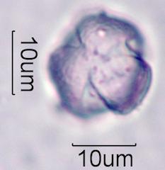 Foxglove (Digitalis purpurea) Pollen