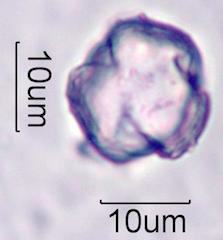 Foxglove (Digitalis purpurea) Pollen