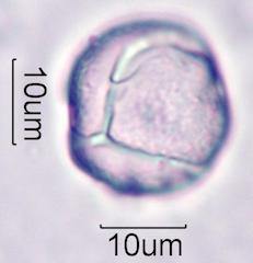 Foxglove (Digitalis purpurea) Pollen