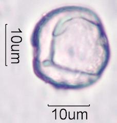 Foxglove (Digitalis purpurea) Pollen