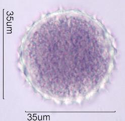 Desert Globemallow (Sphaeralcea ambigua) Pollen