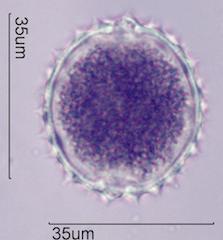Desert Globemallow (Sphaeralcea ambigua) Pollen