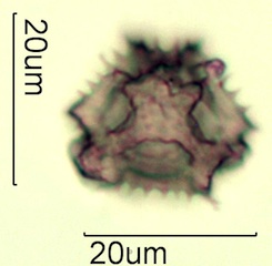 Australian Honey Pollen Under the Microscope