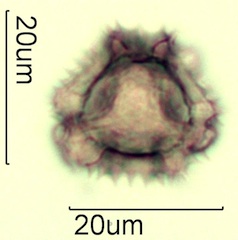 Australian Honey Pollen Under the Microscope