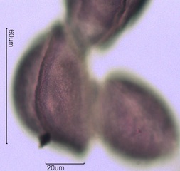 Snow Lily Pollen under the Microscope