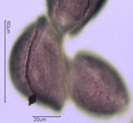 Snow Lily Pollen under the Microscope