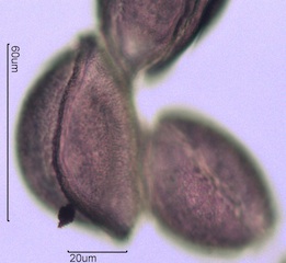 Snow Lily Pollen under the Microscope
