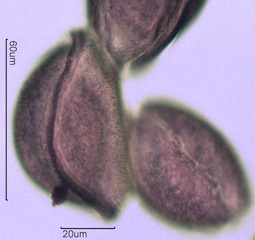 Snow Lily Pollen under the Microscope