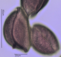Snow Lily Pollen under the Microscope