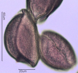 Snow Lily Pollen under the Microscope