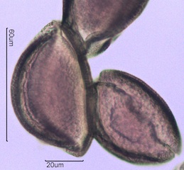 Snow Lily Pollen under the Microscope