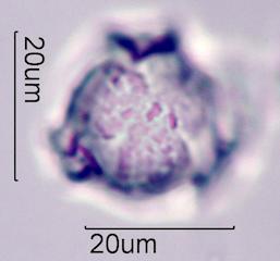 Lupine (Lupinus sp.) Pollen
