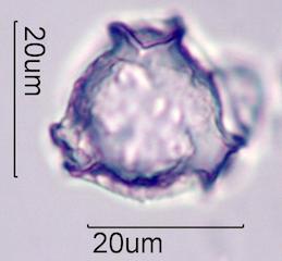 Lupine (Lupinus sp.) Pollen