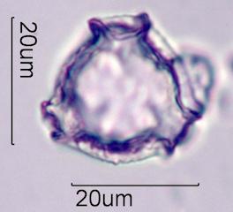 Lupine (Lupinus sp.) Pollen
