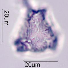 Lupine (Lupinus sp.) Pollen