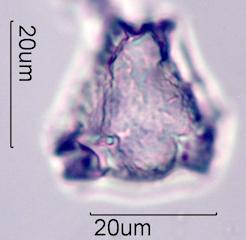 Lupine (Lupinus sp.) Pollen